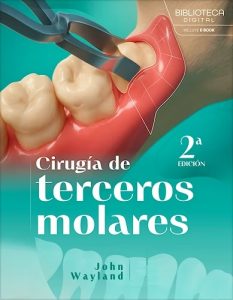 Cirugía de Terceros Molares