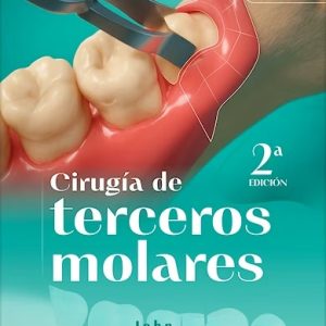 Cirugía de Terceros Molares