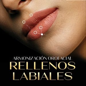 Armonización Orofacial - Rellenos Labiales