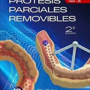 Prótesis Parciales Removibles