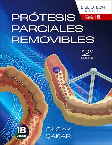 Prótesis Parciales Removibles