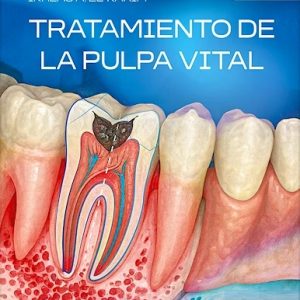 Tratamiento de la Pulpa Vital