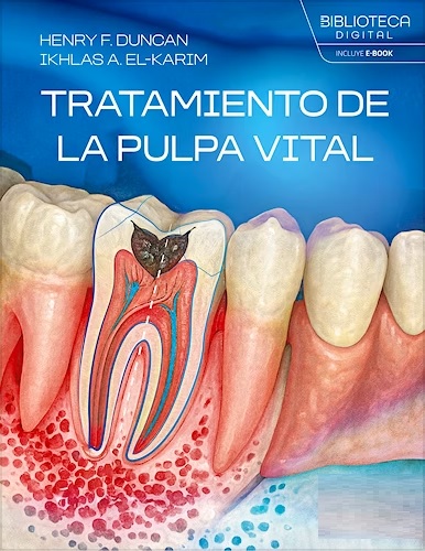 Tratamiento de la Pulpa Vital