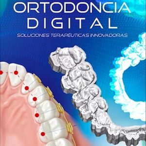 Ortodoncia Digital. Soluciones Terapéuticas Innovadoras