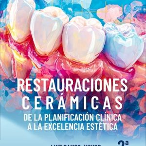 Restauraciones Cerámicas. De la Planificación Clínica a la Excelencia Estética