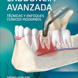 Exodoncia Avanzada. Técnicas y Enfoques Clínicos Modernos