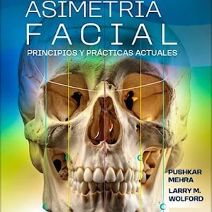 Manejo de la Asimetría Facial. Principios y Prácticas Actuales
