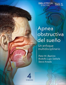 Apnea Obstructiva del Sueño. Un Enfoque Multidisciplinario