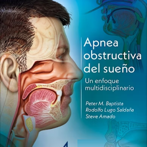 Apnea Obstructiva del Sueño. Un Enfoque Multidisciplinario