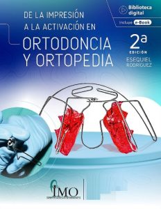 De la Impresión a la Activación en Ortodoncia y Ortopedia