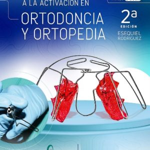 De la Impresión a la Activación en Ortodoncia y Ortopedia