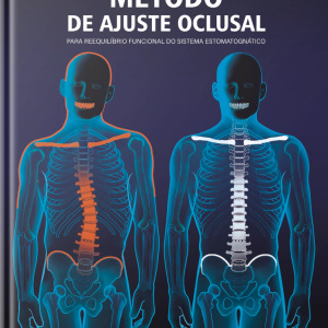 Método de Ajuste Oclusal para Reequilíbrio Funcional do Sistema Estomatognático