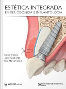 Estética Integrada en Periodoncia e Implantología