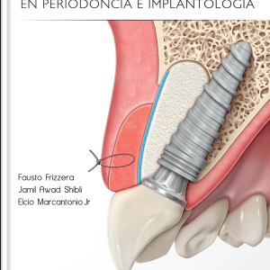Estética Integrada en Periodoncia e Implantología