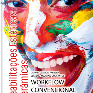 Reabilitações Estéticas Cerâmicas - Workflow Convencional e Digital